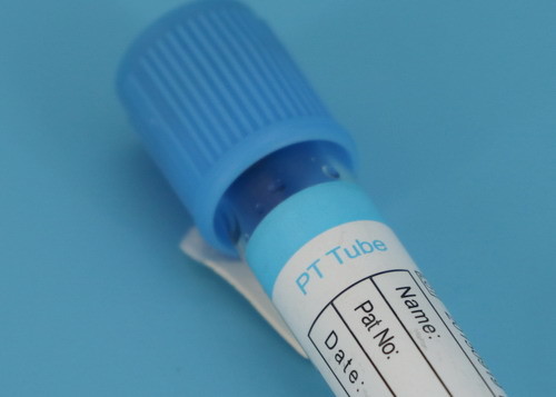Buy cheap Medical Disposable Centrifuge Tube / Blood Collection Tube CE ISO Approved product