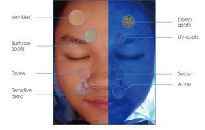 Buy cheap Home Uv Analyzer Facial Moisture 9kg Nw With Tablet Configuration product