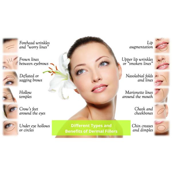 2ml Pcl Skin Booster Polycaprolactone Stimulating Skin Collagen Regeneration