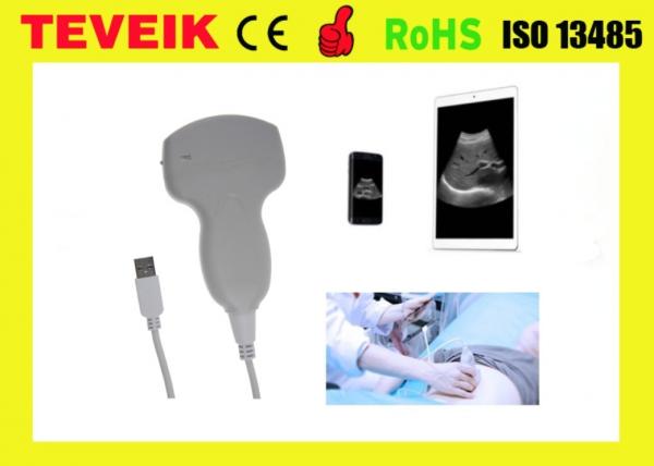 Quality Cheaper USB Convex Probe Mini Ultrasound Device USB ultrasound scanner For Laptop/ Mobile for sale