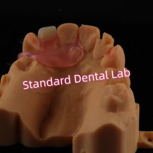 Buy cheap Upper Valplast Unilateral Dentures Removable Flexible One Tooth Partial Teeth product