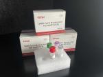 SARS-CoV-2 RT PCR Test Kits Nucleic Acid Throat Swab Sample Fluorescence