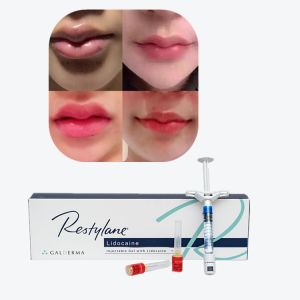 Buy cheap Juvederm Cross Linked Injectable Dermal Filler For Lips product