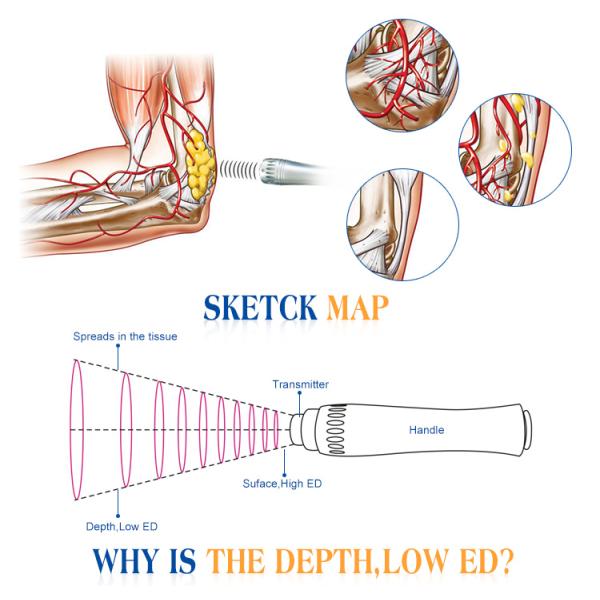 White Shockwave Therapy Machine CE Approval Portable Shockwave Therapy Device