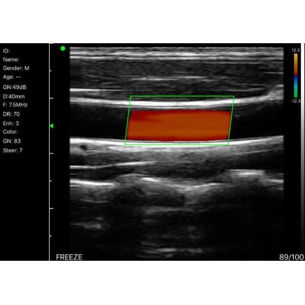 Doppler Ultrasound Equipment Hand held Doppler Machine 128 Elements 90~200mm Depth 235g Weight Wifi Connection