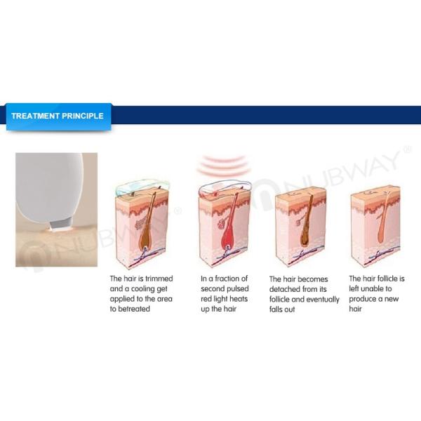 Professional 3 years warranty laser hair removal 808 diode machine