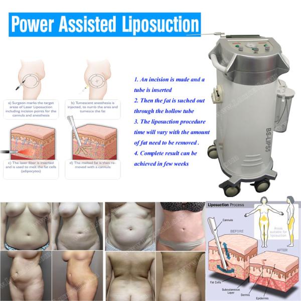 Professional PAL liposuction machine surgical fat reduce liposuction CE approved power assisted liposuction machine