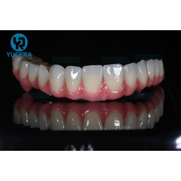 Lab Teeth Gems Dental Zirconia Block Bridge Tooth Zirconia Block