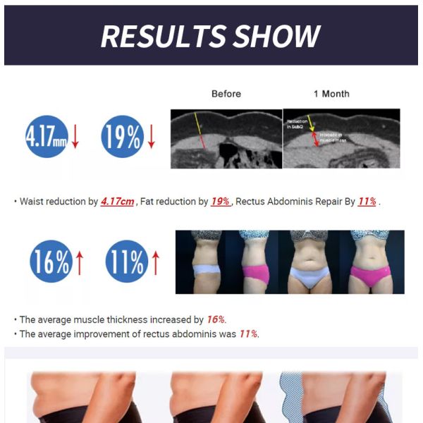 Ce 13 Tesla Ems Slim Machine , Body Sculpting Machine