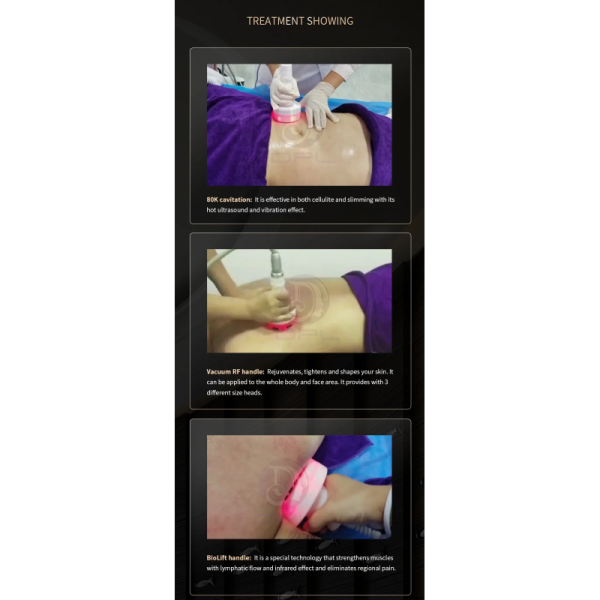 80K Weight Loss Cavitation Machine Rf Cavitation Machine Ultrasonic Slimming Machine 6 In 1 Skin Firm Wrinkle Removal