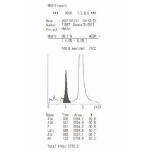 HPLC Medical Laboratory HbA1c Analyzer