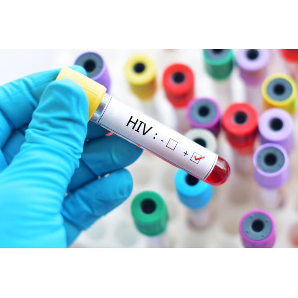 Qualitative Screening 99% Specificity CIA HIV Rapid Test Kit