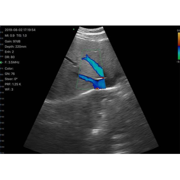 Support Printing Reports Handheld Ultrasound Scanner 13 Application 6 Language App Free IOS Android Windows Compatible 1