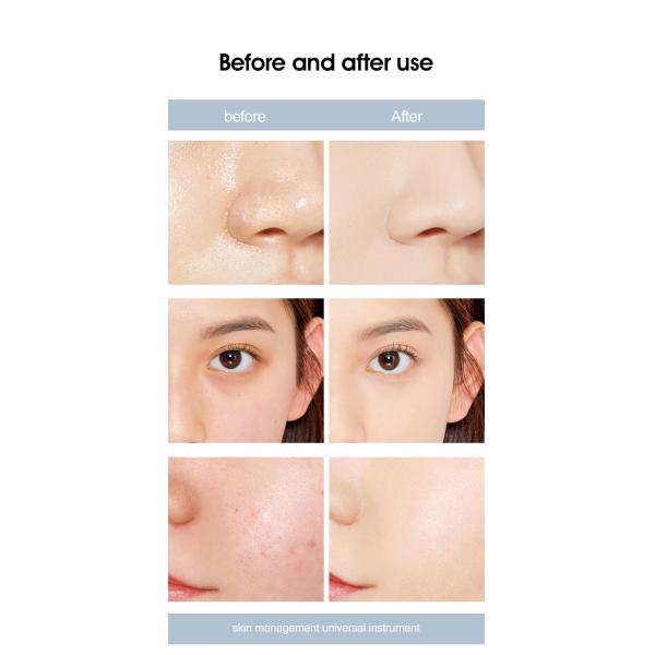 9-in-1 Diamond Peel Machine with Water Oxygen Jet for Aqua Dermabrasion Deep cleansing Skin Tightening and Linghting