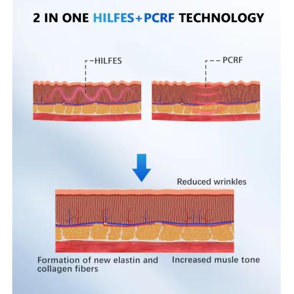 Portable MFFACE Pe-Face RF Microcurrent Face Lifting Double Chin Removal Machine
