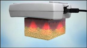 Lipo Laser Slimming Machine portable Fat Reduction For body shaping