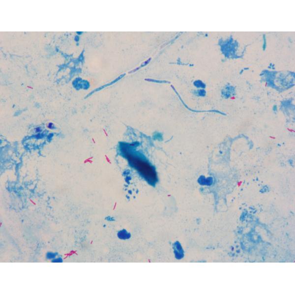 4×250mL 4×500mL 4×100mL Ziehl Neelsen TB Stain For Identification Of Acid Fast Bacteria