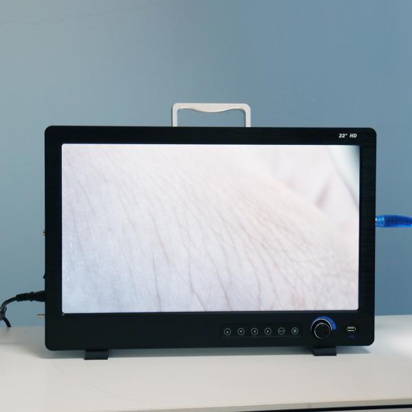 Portable Full HD Endoscope Camera For ENT Laparoscopy Hysteroscopy Cystoscopy Surgery Equipment