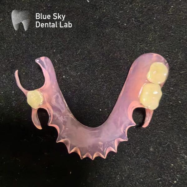 Customize Removable Acrylic Partial Denture Natural Looking Valplast Dental