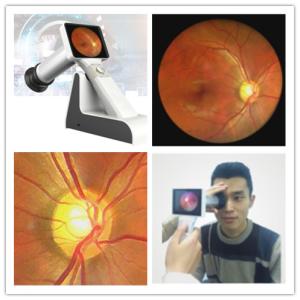Buy cheap Portable Handheld Wifi Digital Ophthalmoscope For Eye Fundus product
