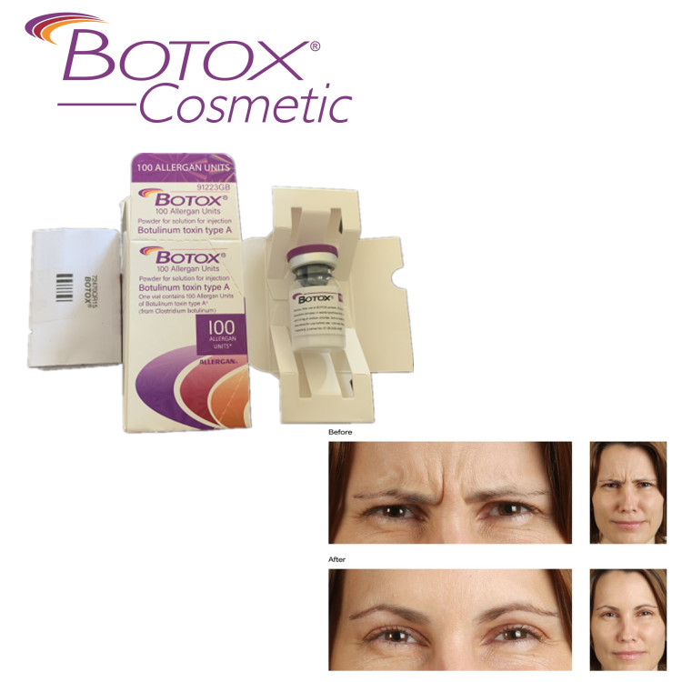 Buy cheap Allergan Injectable For Forehead Wrinkles 100ui product