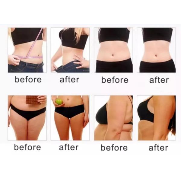 Lipolytic Slimming Fat Dissolving Solution For Face Double Chin Belly Body