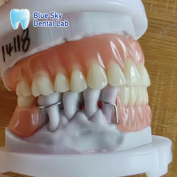 Custom Full Upper Acrylic Denture Natural Acrylic Removable Partial Denture