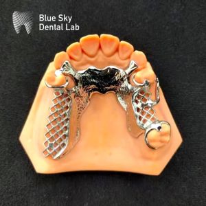 Buy cheap Skelete Chrome Metal Partial Denture Printed CoCr Denture Design product