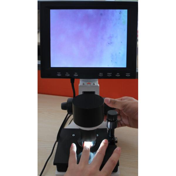 Magnification 400 Times Digital Microcirculation Microscope Nailfold Microcirculation Equipment