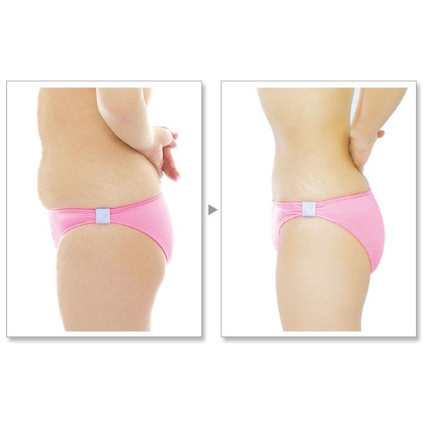 Newest lipo laser slimming machine,professional cryolipolysis fat slimming machine