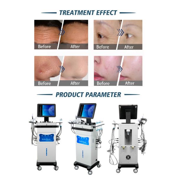 Vertical Multifunction Oxygen Jet - Hydra Beauty Machine for beautiful Nose