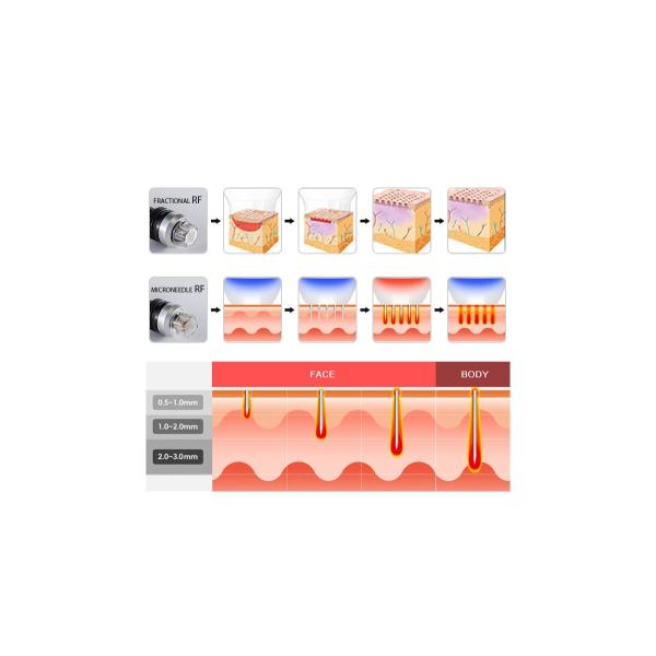 face beauty equipment