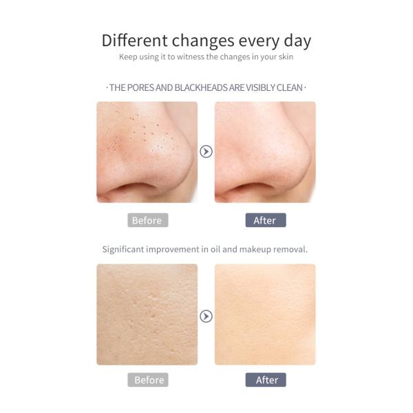 Type C Ultrasonic Facial Skin Scrubber Spatula Ultrasound Face Skin Cleansing Scrubber