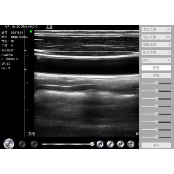 Doppler Ultrasound Equipment Hand held Doppler Machine 128 Elements 90~200mm Depth 235g Weight Wifi Connection