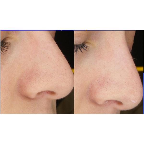 Hot sale intelligent skin analyzer machine with high resolution