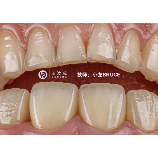 Preshaded 3D Plus Multilayer Dental Zirconia Disc D98 Open System