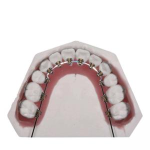 Buy cheap Straight Wire Fixed Orthodontic Appliances For Teeth Straightening product