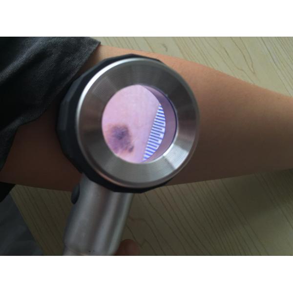 High Accuracy Optical Magnifier 10 Times Dermatoscope Skin Analyer Using 2 * AA No.5 Batteries Metal Optical Glass Lens