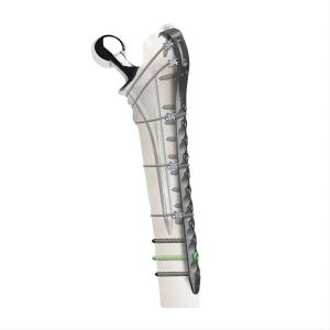 Buy cheap Titanium Alloy Locking Plate For Periprosthetic Fractures product