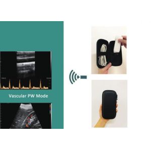 Ce Linear 7.5mhz Wifi Portable Ultrasound Scanners