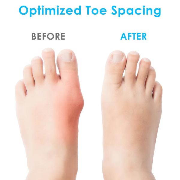 Silicone Toe Spacers For Correct Toe , Silicone Toe Separators For Bunions
