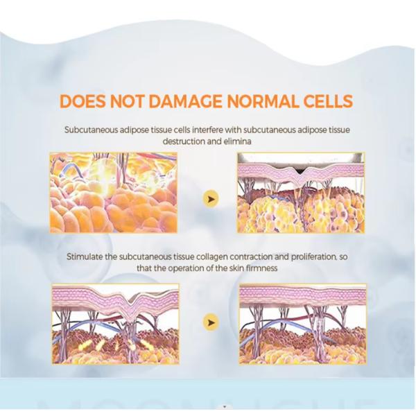 Monopolar RF Cet Face Lifting Ret Body Contouring 448kHz Tecar Machine