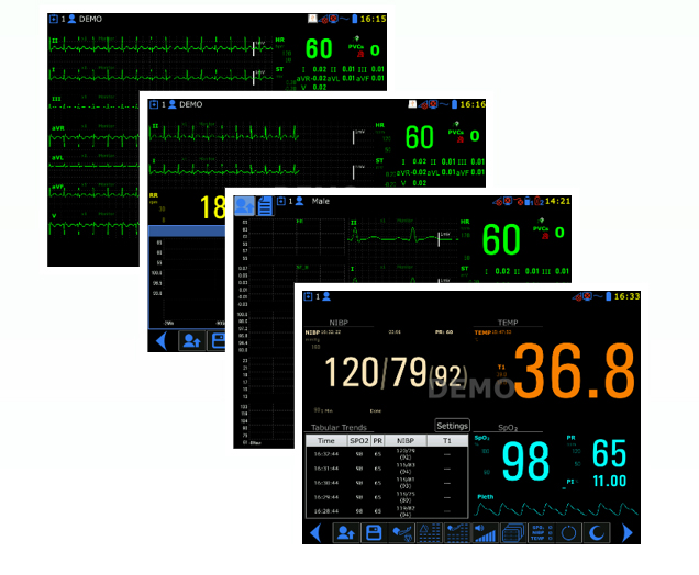 Economy portable 10.4 inch heart rate bedside patient monitor vital monitor for medical use