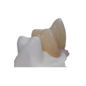 Buy cheap Removable Pure Titanium Dental Implant Bar Custom Abutment product