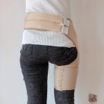 OEM-Ready Prosthetic Sling with Biomechanical Rehabilitation Optimization