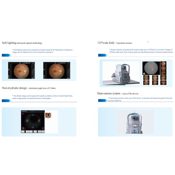 Automatic Retinal Imaging Fundus Camera 135° Wide Field 17mm Working Distance