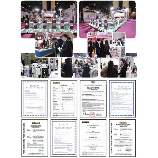 Effective Nd Yag Laser Machine Laser Handle 532nm Wavelength 6hz Frequency