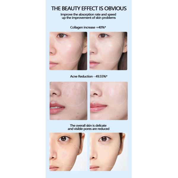 DC5V Auto Digital Derma Pen Microneedling Pen For Home Use