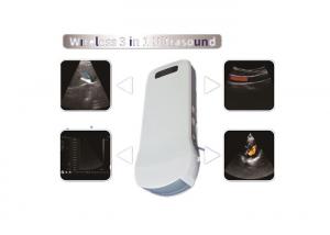 Buy cheap Color Doppler Sonography Color Doppler Ultrasound Scanner With Built-in WiFi Signal Wireless Charging 2.5MHz~10MHz Freq product