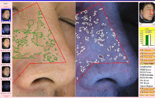 Hot sale intelligent skin analyzer machine with high resolution